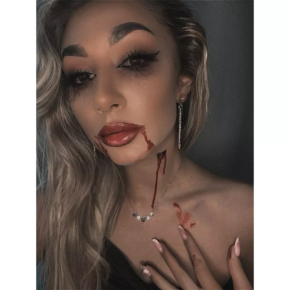 Małgorzata Główka z zespołu Camasutra cała we krwi?! Gwiazda disco polo nie do poznania! 